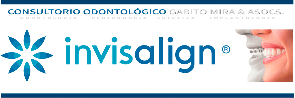 Invisalign